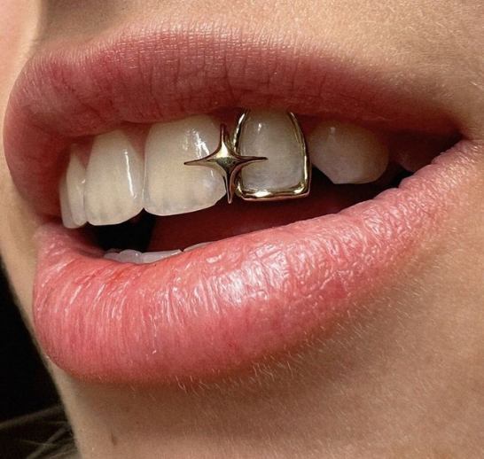 Root Canal Treatment